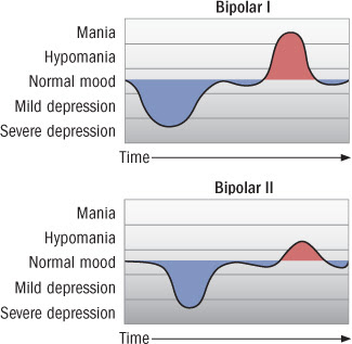 child depression