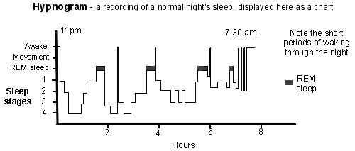 hypnogram